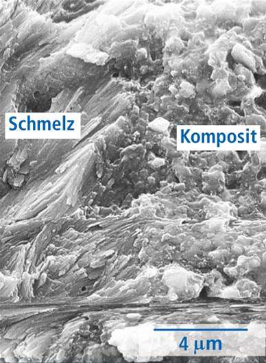 Gel condizionatore per denti