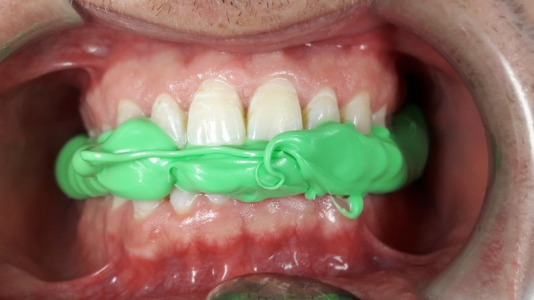 Hydroline thixotrop Key
